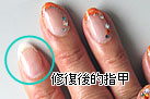 Nail Repair